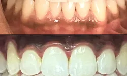 Thumbnail control image for a collage of teeth